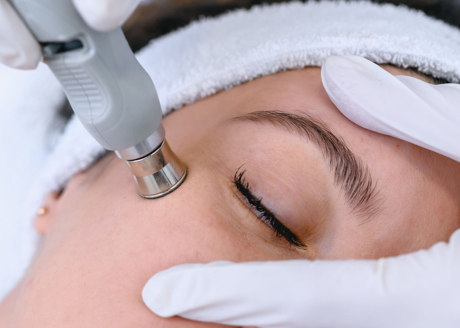 Best Non-Surgical Anti-Aging Treatments: Botox, Fillers, and More